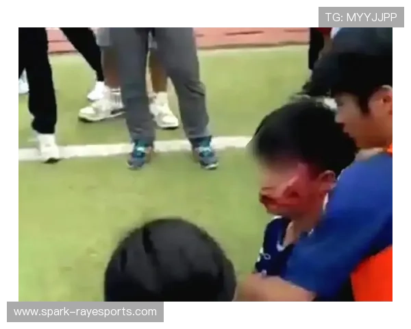 足球球星遭对手恶意踩脚受伤 赛场暴力行为引发热议